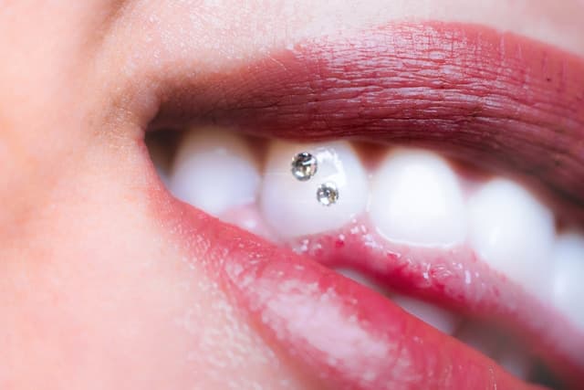 Strass dentaire — Nelia Beauty Saint-Louis